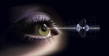 Gleitsichtgläser Gleitsichtbrille Augenoptiker Kontaktlinsenspezialist Optometrie Winkelfehlsichtigkeit